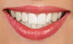 houseoforthodontia-invisalign-2