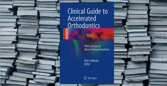 accelerated orthodontics