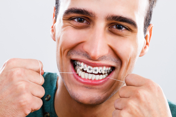 houseoforthodontia-Dental hygiene