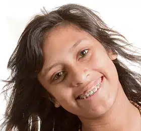 Orthodontics for Teens Orthodontics for Teens