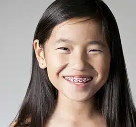 houseoforthodontia-retainer-instructions