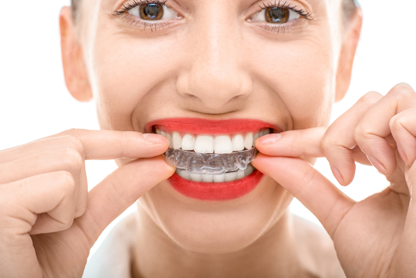 Smile Direct Club Vs. Invisalign - House of Orthodontia