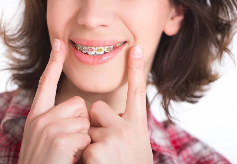 Best Orthodontist Near Me East Village East Village House of Ortho