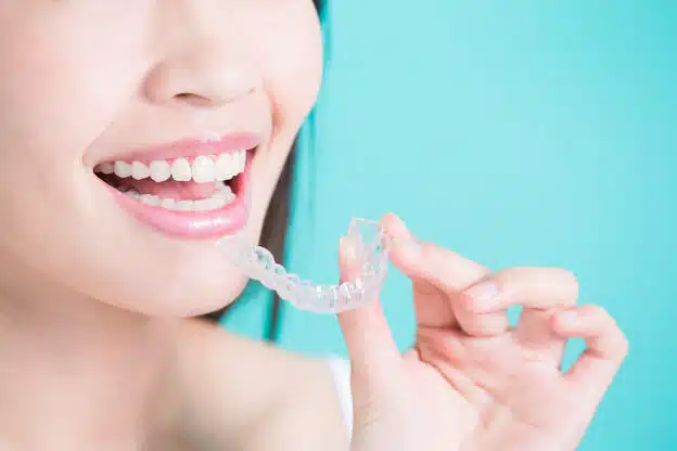 Invisalign Aligners