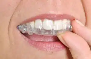 invisalign near me
