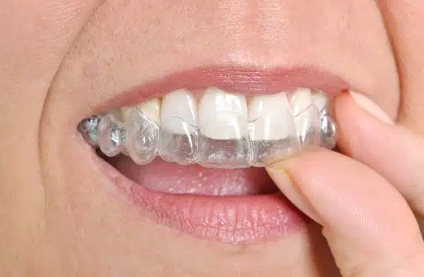 invisalign near me