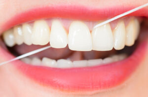 Flossing - a Vital Element of Dental Health