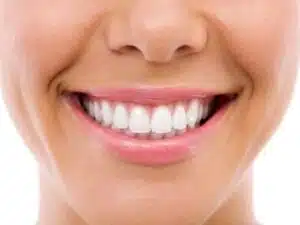 Are Your Teeth Misaligned