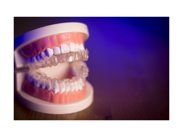 How To Insert Invisalign And Remove House Of Orthodontia