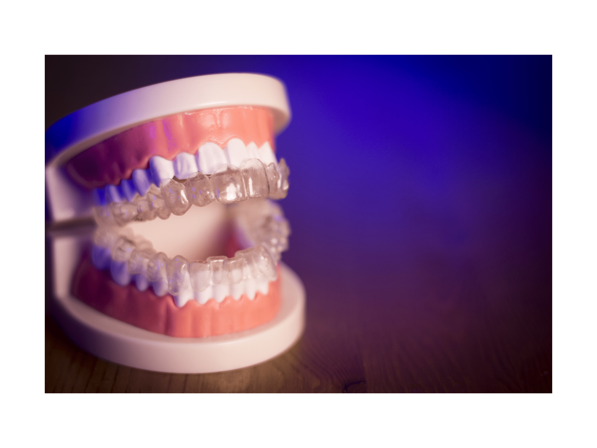 How to Insert Invisalign & Remove - House of Orthodontia