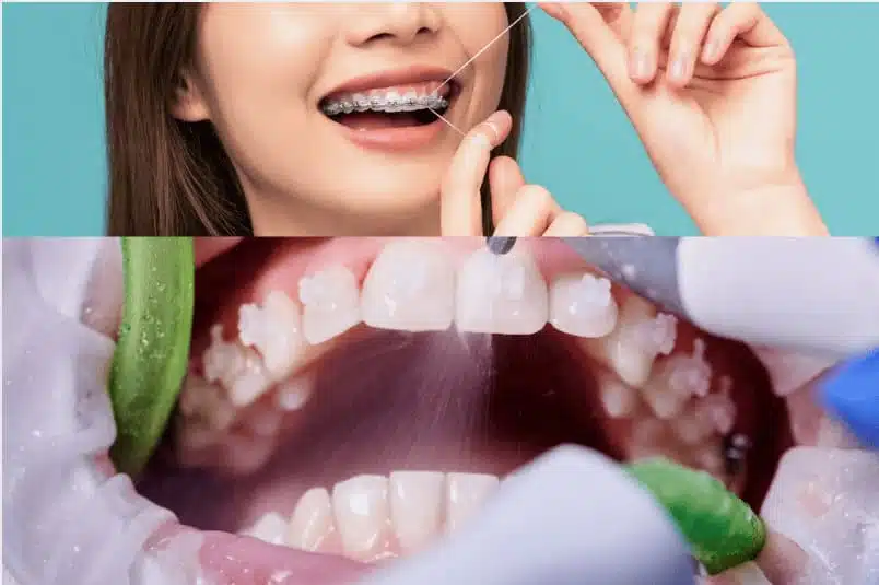 Oral Health Benefits