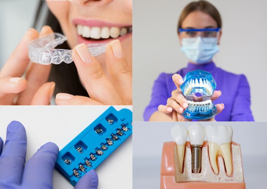 Accelerated Orthodontics