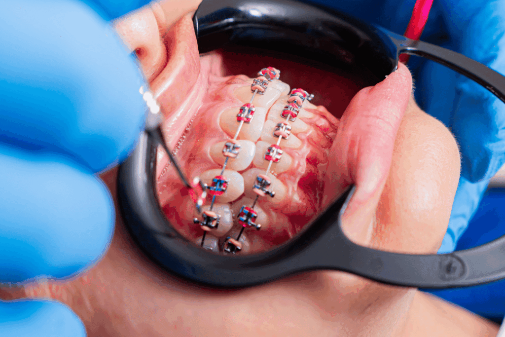 Orthodontist adjusting teen’s metal braces