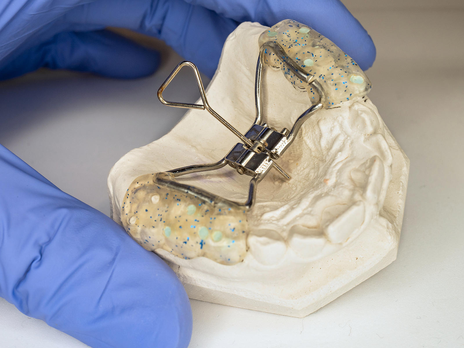 upper jaw expander