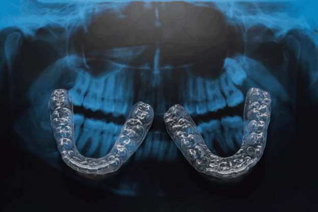 Invisalign for adults enhancing airway efficiency