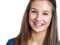Teen girl smiling with braces during orthodontic treatment in Forest Hills NY