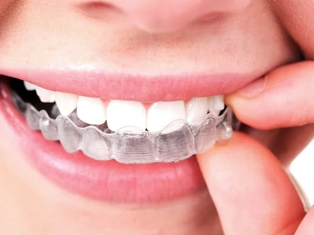 Invisalign in NYC