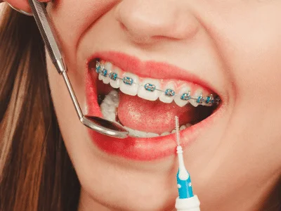 Braces east village