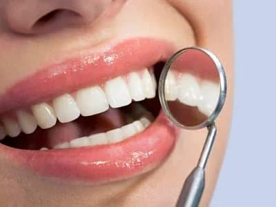 Are Your Teeth Misaligned 2